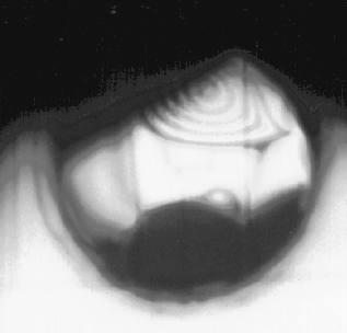 \begin{figure}\centering\epsfig{figure=bilder/memb1_4,width=7cm,clip=} \end{figure}